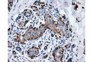 Immunohistochemical staining of paraffin-embedded breast tissue using anti-ANXA1 mouse monoclonal antibody. (Annexin a1 antibody)