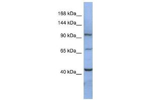 WB Suggested Anti-RBM12  Antibody Titration: 0. (RBM12 antibody  (N-Term))