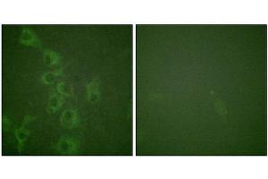 Immunofluorescence staining of methanol-fixed HuvEc cells using Histamine H1 Receptor (Phospho-Ser398) Antibody. (HRH1 antibody  (pSer398))
