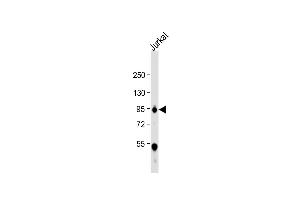 Anti-WEE1 Antibody  at 1:1000 dilution + Jurkat whole cell lysate Lysates/proteins at 20 μg per lane.