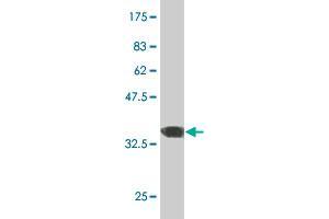 Western Blot detection against Immunogen (36. (ERN1 antibody  (AA 401-500))