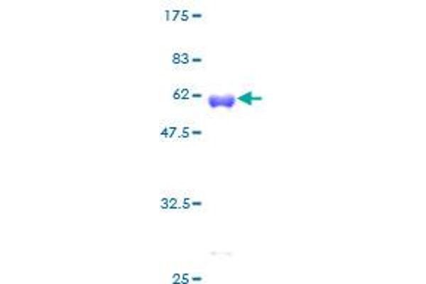 PCNA Protein (AA 1-261) (GST tag)