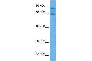 Western Blotting (WB) image for anti-Autoimmune Regulator (AIRE) (N-Term) antibody (ABIN2779777)