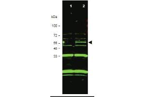 Western blot using anti-ING3 antibody shows detection of a band at. (ING3 antibody  (Isoform 1))