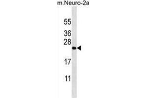 ZCRB1 Antibody (C-term) western blot analysis in mouse Neuro-2a cell line lysates (35 µg/lane). (ZCRB1 antibody  (C-Term))