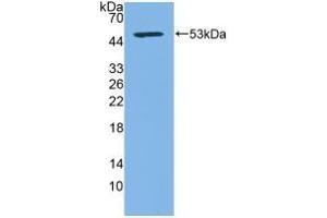 Detection of Recombinant CD83, Human using Polyclonal Antibody to Cluster Of Differentiation 83 (CD83) (CD83 antibody  (AA 24-205))