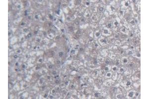 Detection of UCN2 in Human Liver Tissue using Monoclonal Antibody to Urocortin 2 (UCN2) (Urocortin 2 antibody  (AA 20-112))