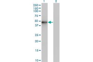 Western Blot analysis of ZNF24 expression in transfected 293T cell line by ZNF24 monoclonal antibody (M02), clone 2G5.