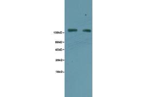 Human rectal carcinoma lysates probed with Anti Phospho-TIF1 beta(Ser824) Polyclonal Antibody, Unconjugated (ABIN746108) at 1:200 overnight at 4 °C. (KAP1 antibody  (pSer824))