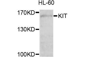 Western blot analysis of extracts of HL-60 cells, using KIT antibody. (KIT antibody)