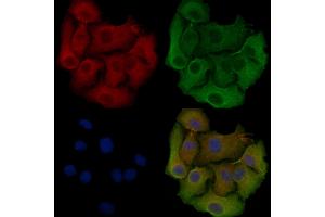ABIN6257342 and ABIN6275523 staining Hela cells by IF/ICC.