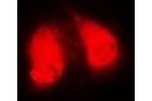 Immunofluorescent analysis of GGA2 staining in MCF7 cells. (GGA2 antibody)