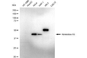 Western blotting analysis using Homeobox A5 antibody (ABIN7798990).