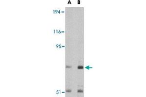 Western blot analysis of TNPO3 in Raji cell lysate with TNPO3 polyclonal antibody  at (A) 1 and (B) 2 ug/mL . (Transportin 3 antibody  (N-Term))