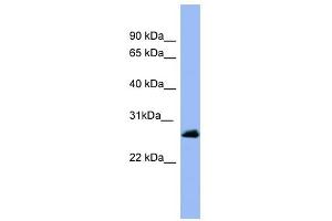RAB5A antibody used at 1 ug/ml to detect target protein. (RAB5 antibody  (Middle Region))