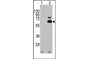 Image no. 1 for anti-Ribosomal Protein S6 Kinase, 70kDa, Polypeptide 1 (RPS6KB1) (Ser404) antibody (ABIN358257)