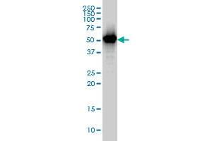 TAPBPL monoclonal antibody (M02), clone 6E3 Western Blot analysis of TAPBPL expression in A-431 . (TAPBPL antibody  (AA 23-121))