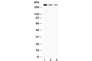 Western blot testing of 1) rat testis, 2) mouse Hepa1-6 and 3) human HepG2 lysate with TECTA antibody at 0. (TECTA antibody  (AA 93-134))