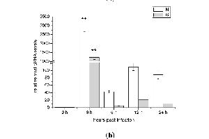 Control (Ct) image for anti-Actin, beta (ACTB) (AA 1-50) antibody (ABIN724340)