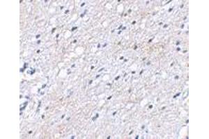 Immunohistochemical staining of human brain tissue using AP30122PU-N BAP3 antibody at 2. (BAIAP3 antibody  (N-Term))