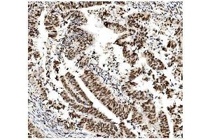 IHC analysis of MCM2 using anti-MCM2 antibody (ABIN7601594).