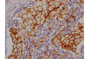 IHC image of ABIN7127318 diluted at 1:100 and staining in paraffin-embedded human lung tissue performed on a Leica BondTM system. (Recombinant Angiotensin I Converting Enzyme 1 antibody)