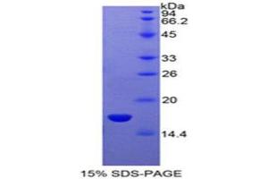 SDS-PAGE (SDS) image for Sema Domain, Immunoglobulin Domain (Ig), Short Basic Domain, Secreted, (Semaphorin) 3A (SEMA3A) (AA 31-141) protein (His tag) (ABIN2126718)