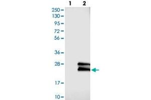 Western blot analysis of Lane 1: Negative control (vector only transfected HEK293T lysate), Lane 2: Over-expression Lysate (Co-expressed with a C-terminal myc-DDK tag (~3. (GAPT antibody)