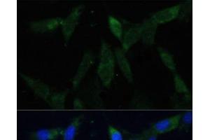 Immunofluorescence analysis of NIH-3T3 cells using ZWINT Polyclonal Antibody at dilution of 1:100 (40x lens). (ZWINT antibody)