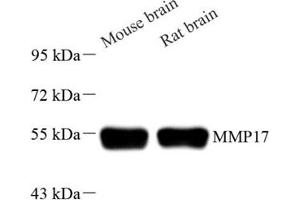 Western blot analysis of MT4-MMP (ABIN7074564) at dilution of 1: 2000 (MMP17 antibody)