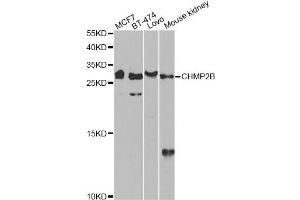 Western blot analysis of extracts of various cell lines, using CHMP2B antibody (ABIN6292876) at 1:1000 dilution. (CHMP2B antibody)