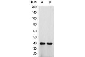 Western blot analysis of ATP6V0D1 expression in HeLa (A), H9C2 (B) whole cell lysates.