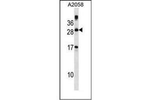 Western blot analysis of PLA2G12A Antibody (Center) in A2058 cell line lysates (35ug/lane).
