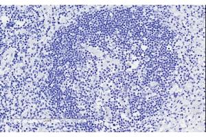 ABIN625822 Negative Control showing staining of paraffin embedded Human Lymph Node, with no primary antibody. (CD28 antibody  (Internal Region))