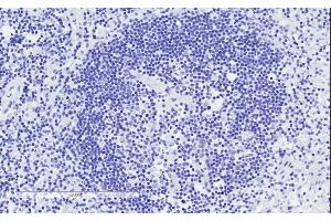 ABIN625822 Negative Control showing staining of paraffin embedded Human Lymph Node, with no primary antibody.