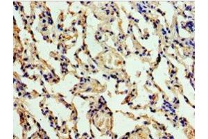 Immunohistochemistry of paraffin-embedded human lung tissue using ABIN7147563 at dilution of 1:100 (ALG1 antibody  (AA 215-464))
