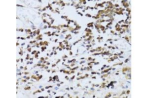 Immunohistochemistry (Paraffin-embedded Sections) (IHC (p)) image for anti-phosphoinositide Kinase, FYVE Finger Containing (PIKFYVE) antibody (ABIN7011299)