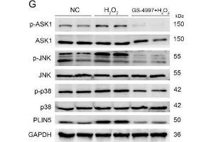 The expression of PLIN5 was regulated by the JNK-p38-ATF pathway. (MAPK14 antibody  (pThr180, pTyr182))
