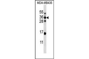 Western blot analysis of ELOVL5 Antibody (C-term) in MDA-MB435 cell line lysates (35ug/lane). (ELOVL5 antibody  (C-Term))
