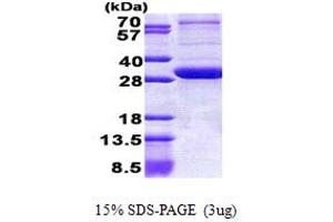 SDS-PAGE (SDS) image for Peroxisomal Biogenesis Factor 26 (PEX26) (AA 1-246) protein (His tag) (ABIN5853072)