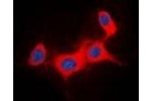 Immunofluorescent analysis of IRS1 staining in HeLa cells. (IRS1 antibody)