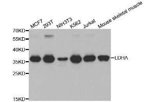 Western blot analysis of extracts of various cell lines, using LDHA antibody. (Lactate Dehydrogenase A antibody  (AA 1-332))