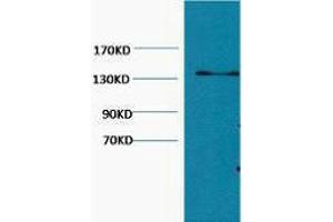 Western Blotting (WB) image for anti-Collagen, Type III (COL3) antibody (ABIN3181193) (COL3 antibody)