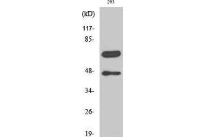 Western Blot analysis of 293 cells with Cleaved-CASP8 (D384) Polyclonal Antibody (Caspase 8 antibody  (Cleaved-Asp384))