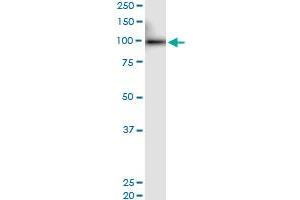 Immunoprecipitation of PRDM1 transfected lysate using anti-PRDM1 MaxPab rabbit polyclonal antibody and Protein A Magnetic Bead , and immunoblotted with . (PRDM1 antibody  (AA 1-789))
