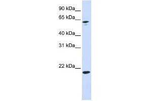 APRT antibody used at 1 ug/ml to detect target protein.