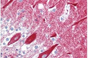 Anti-CPE antibody IHC staining of human brain, cerebellum. (CPE antibody  (AA 36-85))