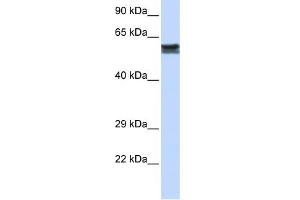 WB Suggested Anti-FYN Antibody Titration: 0. (FYN antibody  (N-Term))