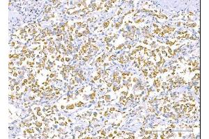 IHC analysis of RALBP1 using anti-RALBP1 antibody (ABIN7600800).