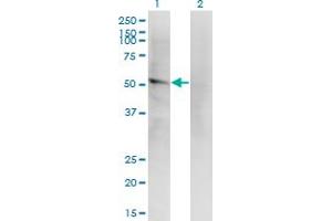 Western Blot analysis of LILRA2 expression in transfected 293T cell line by LILRA2 monoclonal antibody (M14), clone 4D7. (LILRA2 antibody  (AA 1-466))